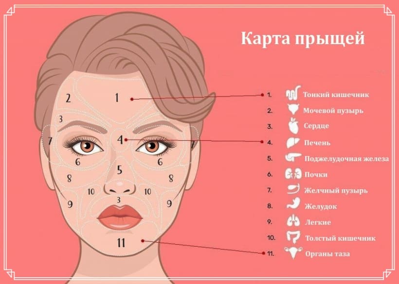 карта заболеваний органов о которых говорят прыщи